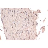 Immunohistochemistry - Anti-EPF Antibody [ARC1411] (A306116) - Antibodies.com