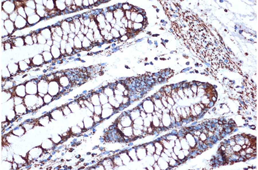 Immunohistochemistry - Anti-EPF Antibody [ARC1411] (A306116) - Antibodies.com