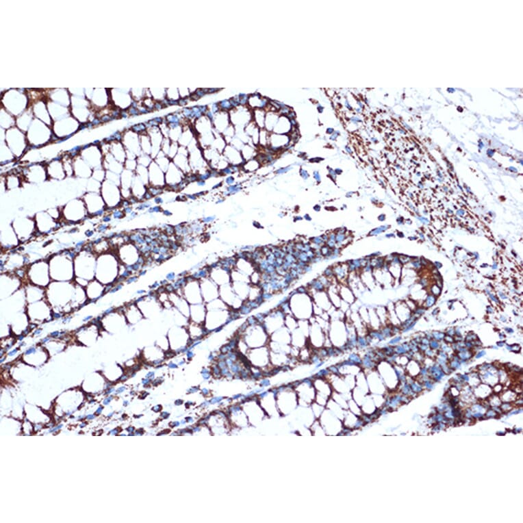 Immunohistochemistry - Anti-EPF Antibody [ARC1411] (A306116) - Antibodies.com