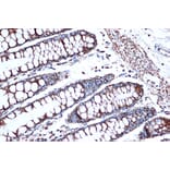 Immunohistochemistry - Anti-EPF Antibody [ARC1411] (A306116) - Antibodies.com
