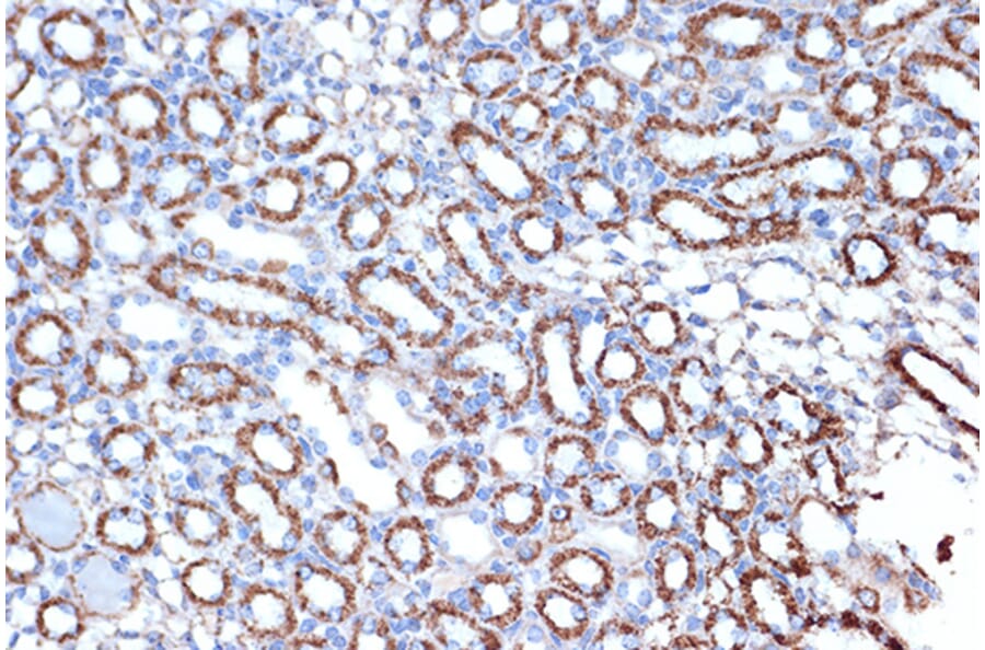 Immunohistochemistry - Anti-EPF Antibody [ARC1411] (A306116) - Antibodies.com