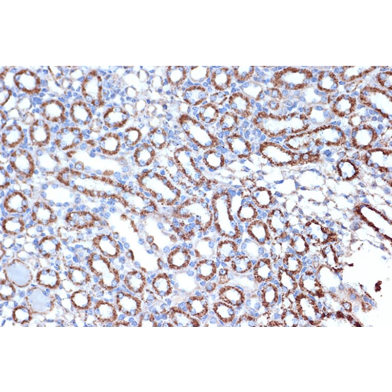 Immunohistochemistry - Anti-EPF Antibody [ARC1411] (A306116) - Antibodies.com