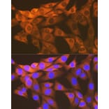 Immunofluorescence - Anti-EPF Antibody [ARC1411] (A306116) - Antibodies.com