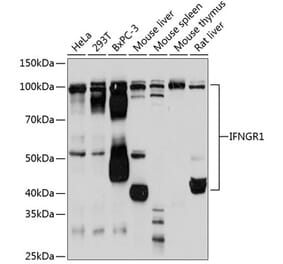 Western Blot - Anti-IFNGR1 Antibody [ARC0662] (A306118) - Antibodies.com