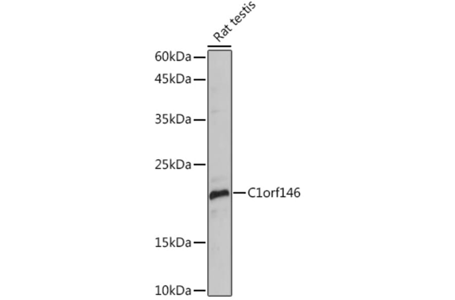 Western Blot - Anti-Spo16 Antibody (A306119) - Antibodies.com