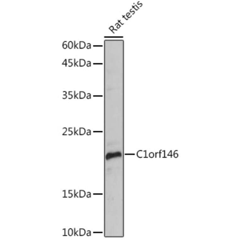 Western Blot - Anti-Spo16 Antibody (A306119) - Antibodies.com