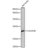 Western Blot - Anti-Spo16 Antibody (A306119) - Antibodies.com