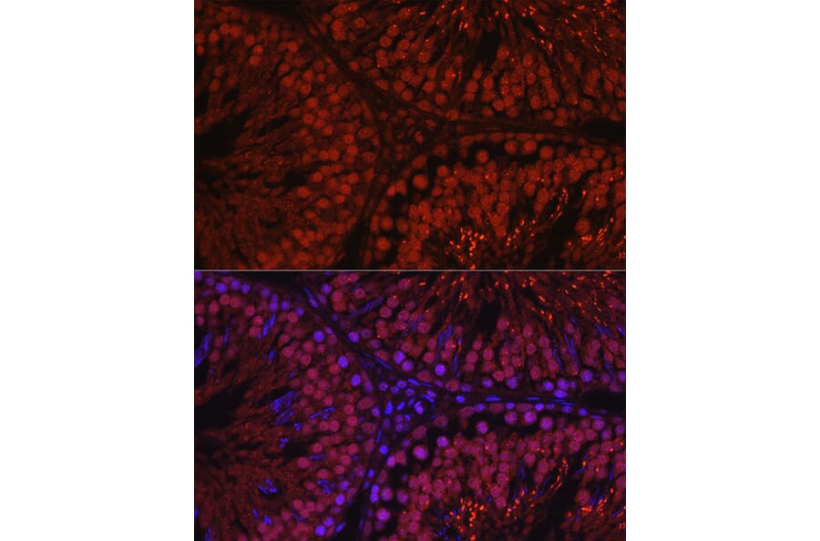 Immunofluorescence - Anti-Spo16 Antibody (A306119) - Antibodies.com