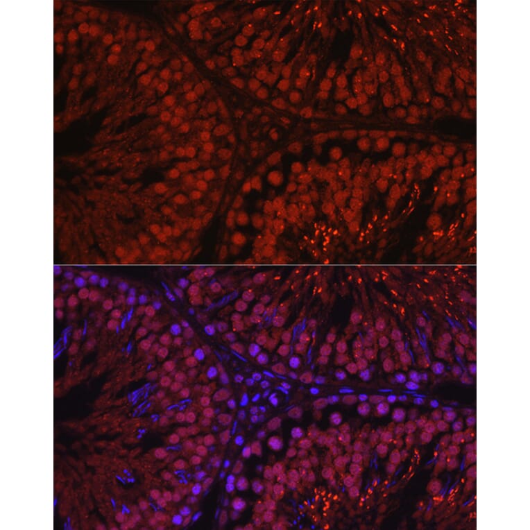 Immunofluorescence - Anti-Spo16 Antibody (A306119) - Antibodies.com