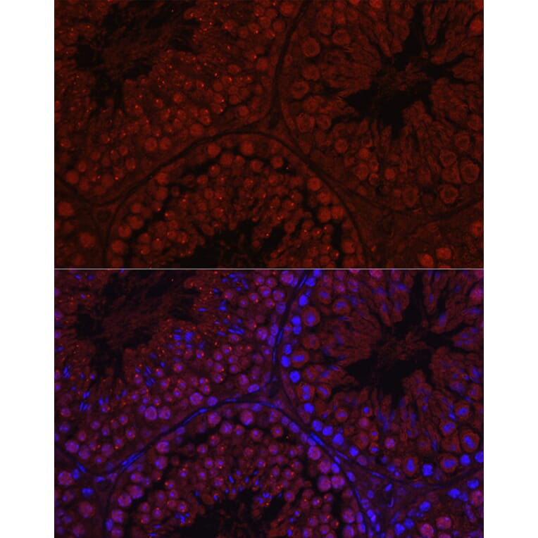 Immunofluorescence - Anti-Spo16 Antibody (A306119) - Antibodies.com