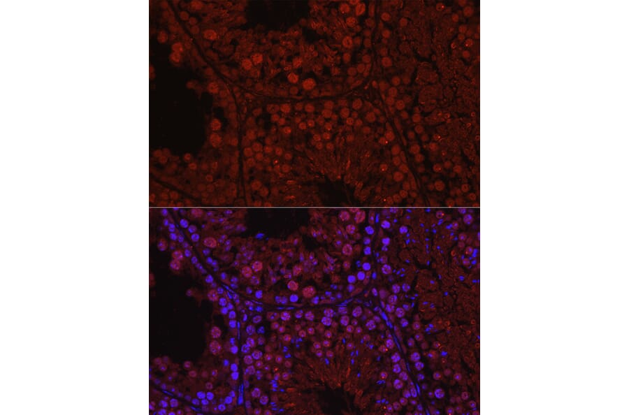 Immunofluorescence - Anti-Spo16 Antibody (A306119) - Antibodies.com