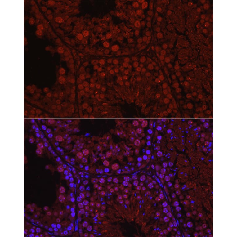 Immunofluorescence - Anti-Spo16 Antibody (A306119) - Antibodies.com