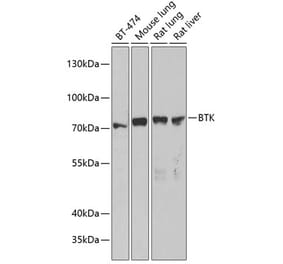 Western Blot - Anti-BTK Antibody (A306120) - Antibodies.com