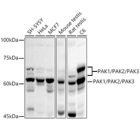 Western Blot - Anti-PAK1 + PAK2 + PAK3 Antibody (A306121) - Antibodies.com