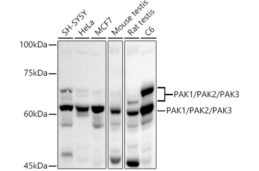 Western Blot - Anti-PAK1 + PAK2 + PAK3 Antibody (A306121) - Antibodies.com
