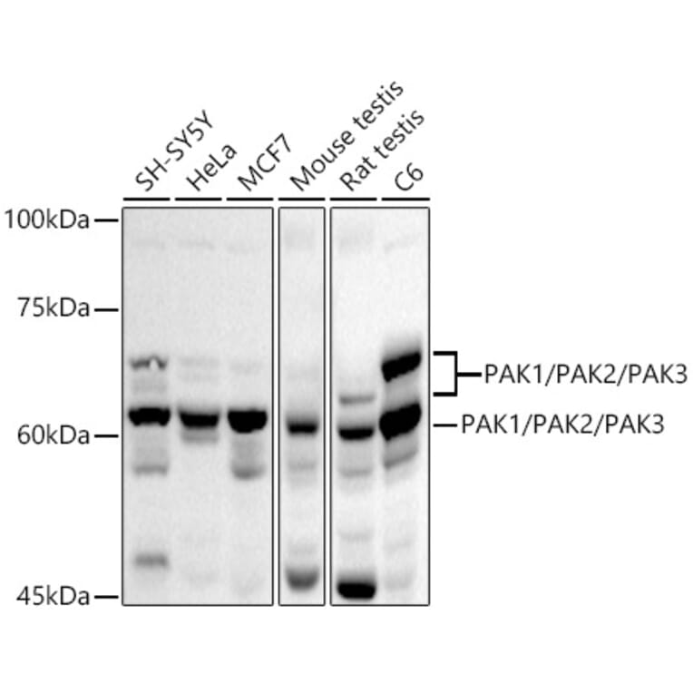 Western Blot - Anti-PAK1 + PAK2 + PAK3 Antibody (A306121) - Antibodies.com
