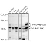 Western Blot - Anti-PAK1 + PAK2 + PAK3 Antibody (A306121) - Antibodies.com