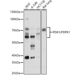 Western Blot - Anti-PDPK1 Antibody (A306122) - Antibodies.com