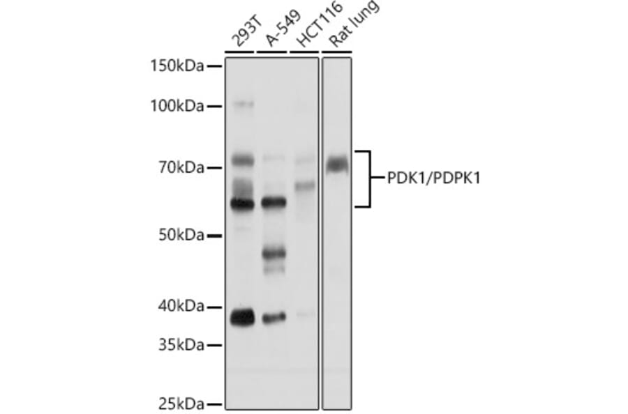 Western Blot - Anti-PDPK1 Antibody (A306122) - Antibodies.com