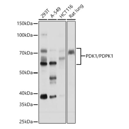 Western Blot - Anti-PDPK1 Antibody (A306122) - Antibodies.com