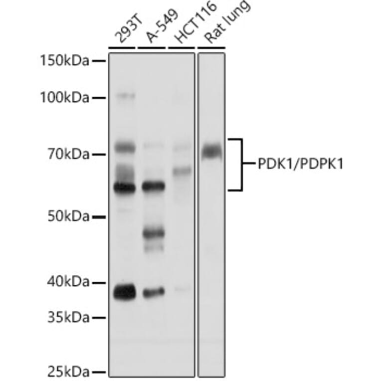 Western Blot - Anti-PDPK1 Antibody (A306122) - Antibodies.com