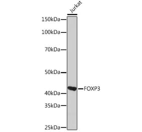 Western Blot - Anti-FOXP3 Antibody [ARC1159] (A306124) - Antibodies.com