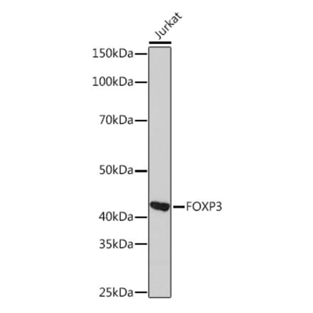 Western Blot - Anti-FOXP3 Antibody [ARC1159] (A306124) - Antibodies.com