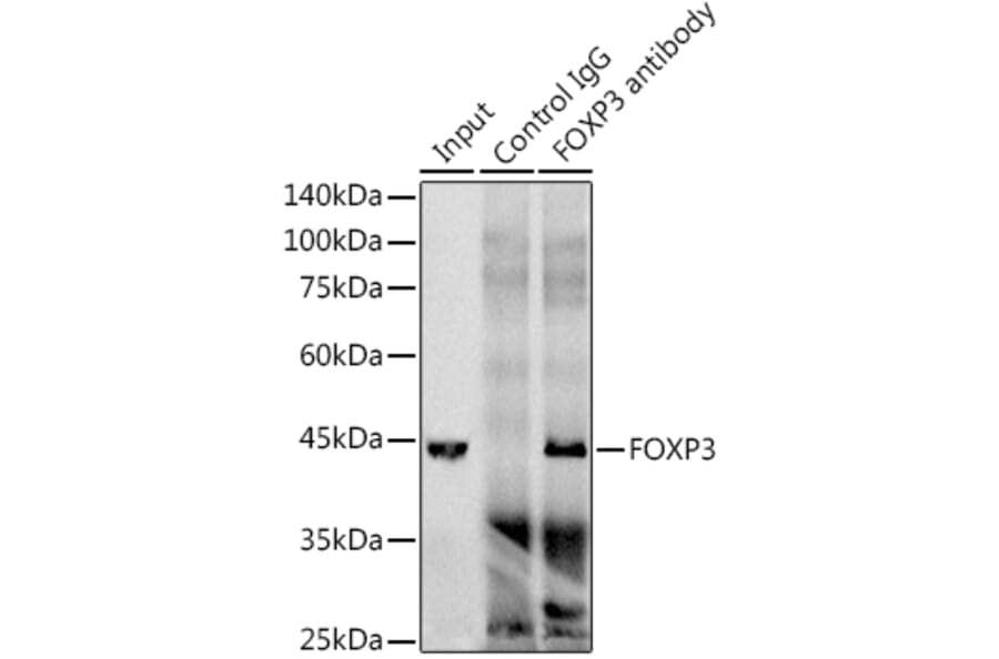Western Blot - Anti-FOXP3 Antibody [ARC1159] (A306124) - Antibodies.com