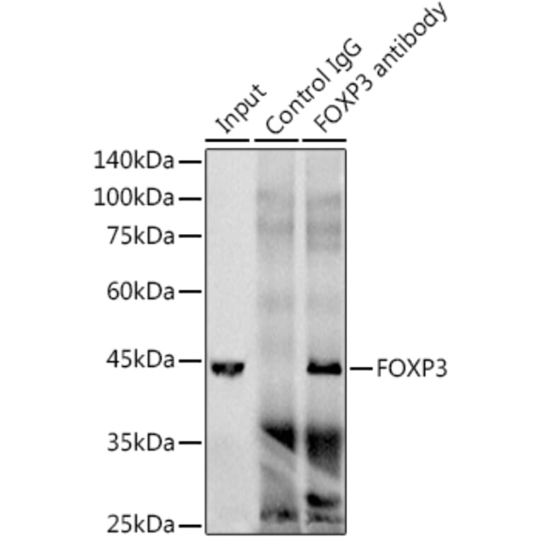 Western Blot - Anti-FOXP3 Antibody [ARC1159] (A306124) - Antibodies.com