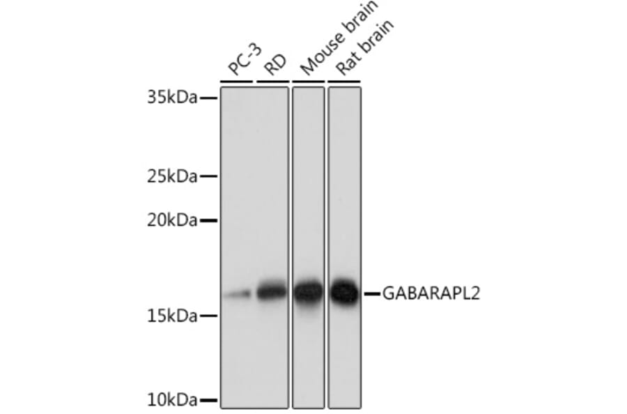 Western Blot - Anti-GABARAPL2/GATE-16 Antibody [ARC1648] (A306125) - Antibodies.com