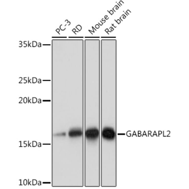 Western Blot - Anti-GABARAPL2/GATE-16 Antibody [ARC1648] (A306125) - Antibodies.com