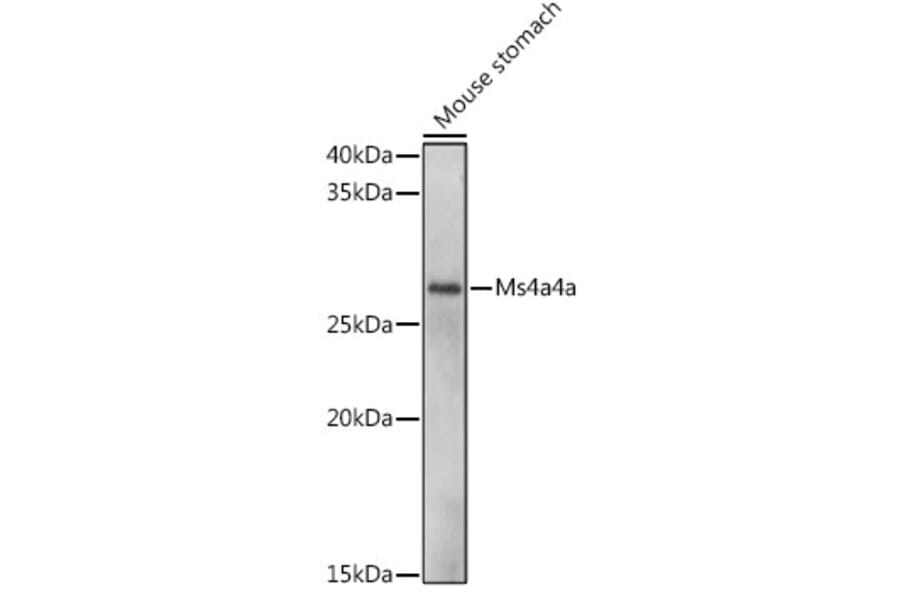 Western Blot - Anti-MS4A4A Antibody (A306126) - Antibodies.com