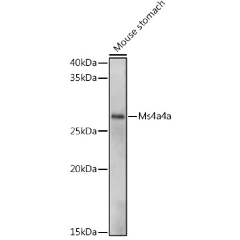 Western Blot - Anti-MS4A4A Antibody (A306126) - Antibodies.com