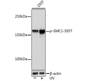 Western Blot - Anti-SMC1A (phospho Ser957) Antibody [ARC1606] (A306127) - Antibodies.com