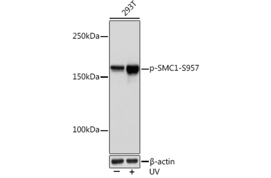Western Blot - Anti-SMC1A (phospho Ser957) Antibody [ARC1606] (A306127) - Antibodies.com