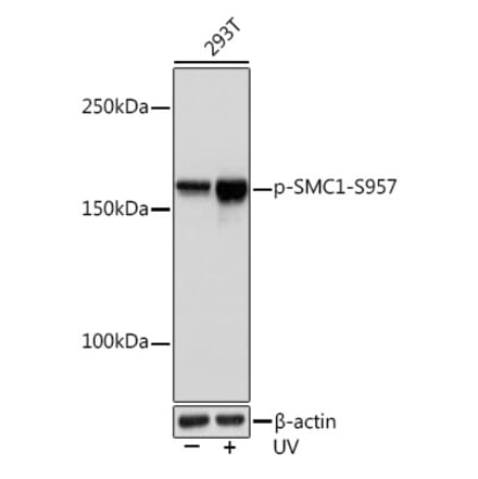 Western Blot - Anti-SMC1A (phospho Ser957) Antibody [ARC1606] (A306127) - Antibodies.com