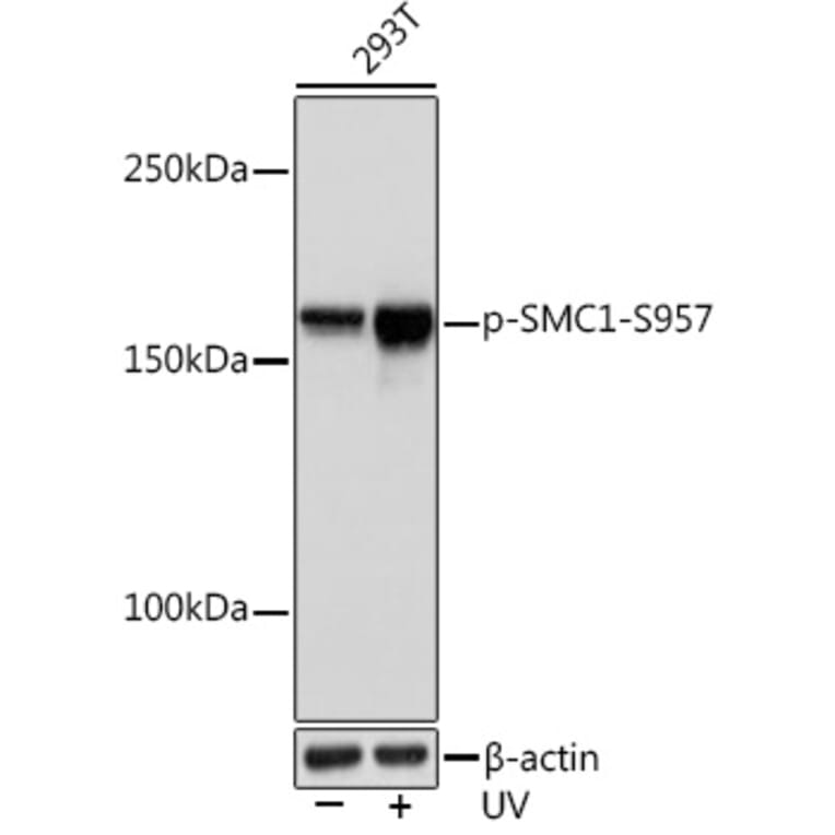 Western Blot - Anti-SMC1A (phospho Ser957) Antibody [ARC1606] (A306127) - Antibodies.com