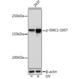 Western Blot - Anti-SMC1A (phospho Ser957) Antibody [ARC1606] (A306127) - Antibodies.com