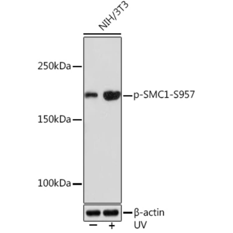 Western Blot - Anti-SMC1A (phospho Ser957) Antibody [ARC1606] (A306127) - Antibodies.com