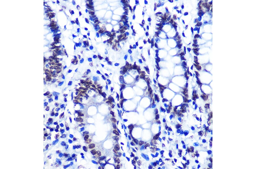 Immunohistochemistry - Anti-SMC1A (phospho Ser957) Antibody [ARC1606] (A306127) - Antibodies.com