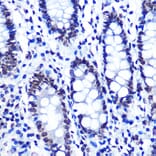 Immunohistochemistry - Anti-SMC1A (phospho Ser957) Antibody [ARC1606] (A306127) - Antibodies.com