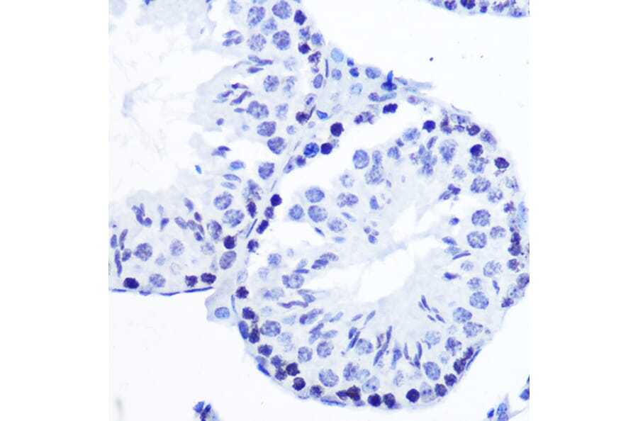 Immunohistochemistry - Anti-SMC1A (phospho Ser957) Antibody [ARC1606] (A306127) - Antibodies.com