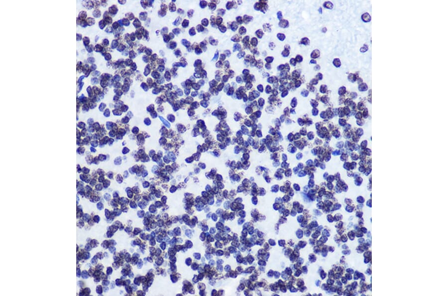 Immunohistochemistry - Anti-SMC1A (phospho Ser957) Antibody [ARC1606] (A306127) - Antibodies.com
