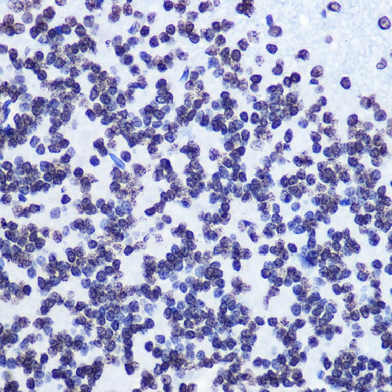 Immunohistochemistry - Anti-SMC1A (phospho Ser957) Antibody [ARC1606] (A306127) - Antibodies.com