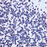 Immunohistochemistry - Anti-SMC1A (phospho Ser957) Antibody [ARC1606] (A306127) - Antibodies.com