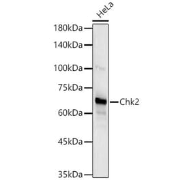 Western Blot - Anti-Chk2 Antibody [ARC57076] (A306128) - Antibodies.com