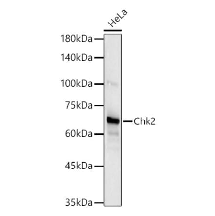 Western Blot - Anti-Chk2 Antibody [ARC57076] (A306128) - Antibodies.com