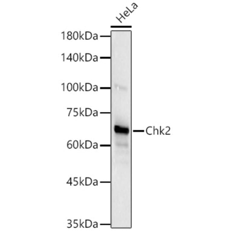 Western Blot - Anti-Chk2 Antibody [ARC57076] (A306128) - Antibodies.com