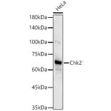 Western Blot - Anti-Chk2 Antibody [ARC57076] (A306128) - Antibodies.com