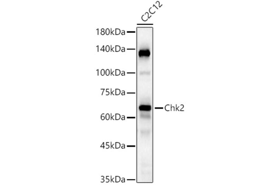Western Blot - Anti-Chk2 Antibody [ARC57076] (A306128) - Antibodies.com
